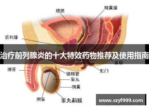 治疗前列腺炎的十大特效药物推荐及使用指南